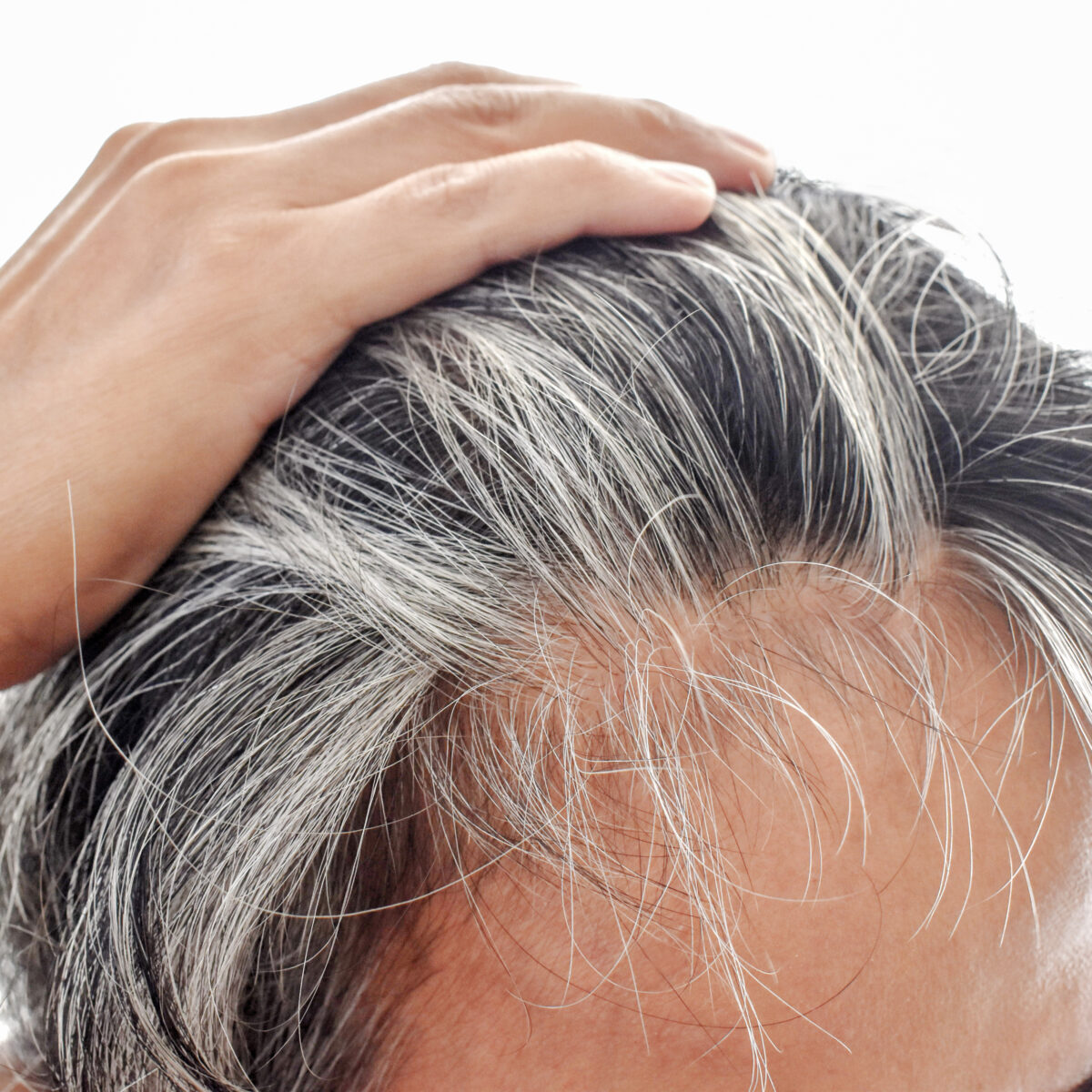 Apa Itu Minuman Kolagen Serta Manfaatnya Bagi Tubuh 4 apa itu minuman kolagen